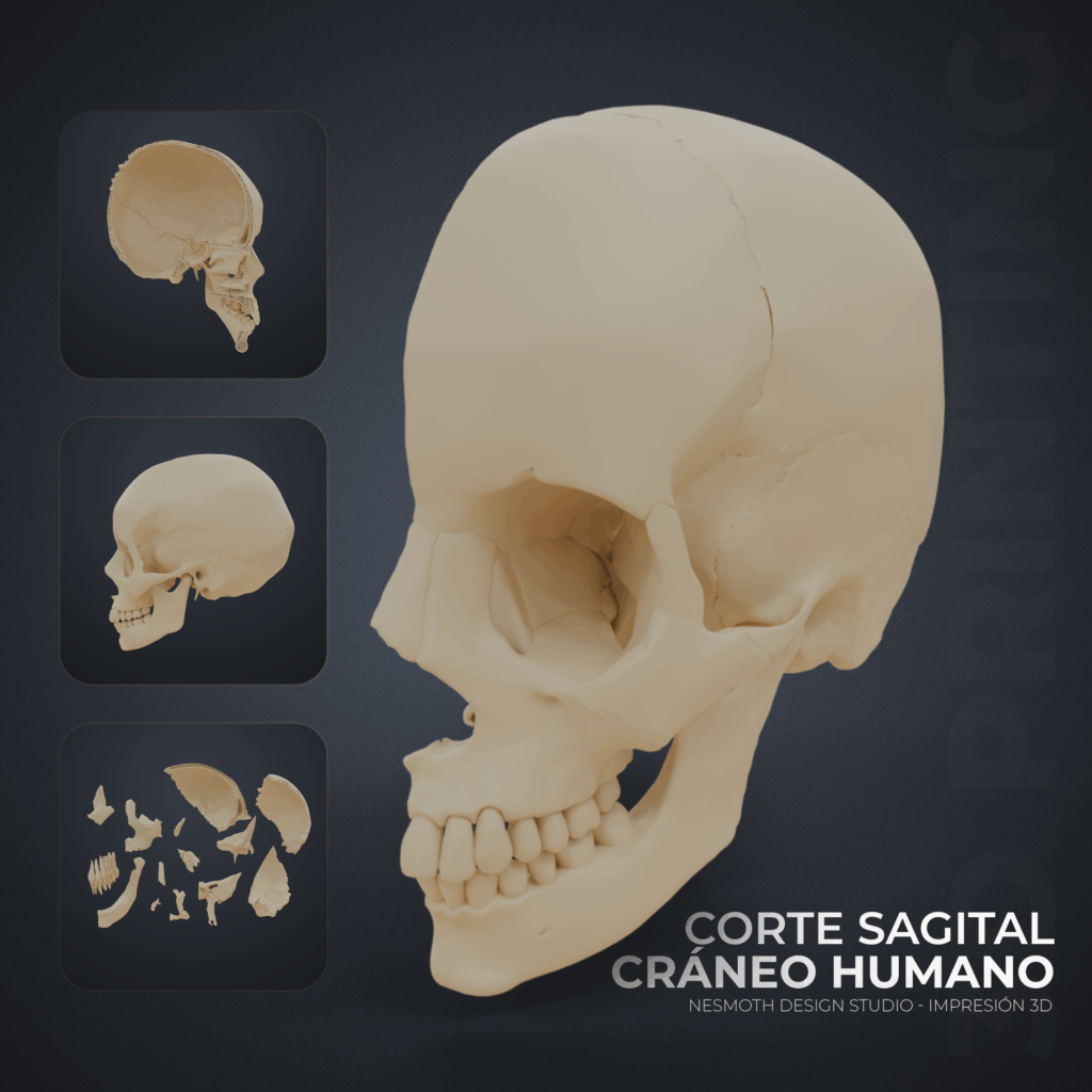 Impresión 3d de Cráneo Humano